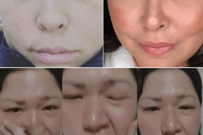 DI INASAHANG PAG-AMIN! Sharon Cuneta, Gary Estrada at ilang kilalang personalidad ay ibinahagi ang kanilang tahimik na LABAN