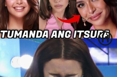 Netizens Shocked Over Yassi Pressman’s New Look After Alleged Cosmetic Enhancements — “Did She Age Overnight?” (NH)