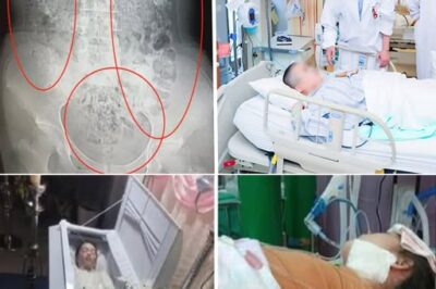 SHOCK WARNING FOR PARENTS: A CHILD LANDED IN THE ICU AFTER DRINKING MILK TEA DAILY — A WAKE-UP CALL FOR EVERY FAMILY